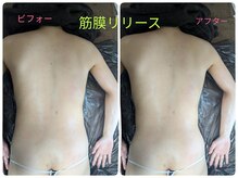 ラグーン(Lagoon)/筋膜リリース