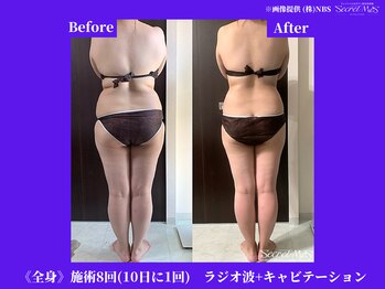 フェレザ 新潟(Felleza)/食生活もとっても重要です！