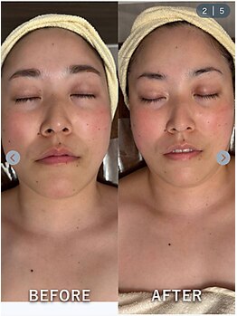 カリズボーテ(karisbeaute)/小顔・リフトアップ・デコルテ