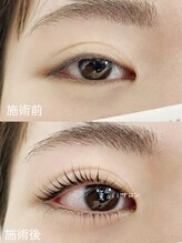 ビオールサロン 池袋東口(美allサロン)/パリジェンヌ上下/マツパ上下