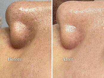 エリー(Ellie)/透き通るような肌に♪