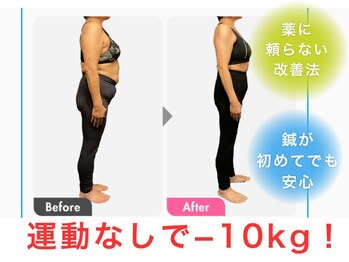 さっぽろ心灯はり・きゅう院/運動なしで3ヶ月マイナス10kg