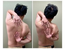 ココア(CoCoa)/肩甲骨洗浄