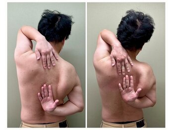 ココア(CoCoa)/肩甲骨洗浄