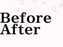 サクラ 本厚木駅前店(SAKURA)/本厚木シミケア/伊勢店シミケア