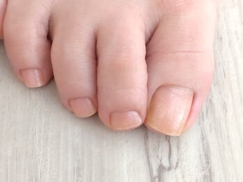 プリナチュール 四日市店の写真/【足爪のお手入れに大人気のフットスパ♪】スクラブ・マッサージ・パック付き★足の疲れが気になる方に◎