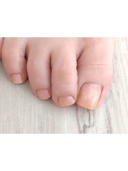 フットケアを受けたい