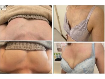 スマイルクルー(SmileClue)/ビフォーアフター症例