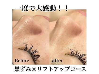 エステサロン ジュエル 高松レインボー店(JEWEL)の写真