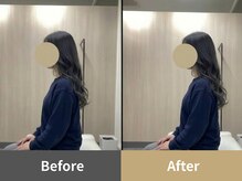 整体クオーレ 奈良新大宮店(Cuore)/Before After