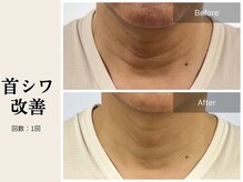 サロン ルイス アディクト(salon Lewis Addict)/ハイアールエフウェーブ