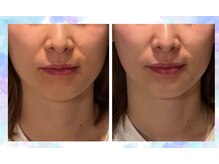 ベリー(Berry)の雰囲気（今からでも変わる☆小顔矯正の技術をぜひご体感ください♪）