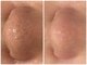 オリ('OLI)の写真