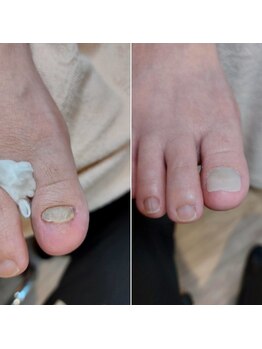 爪切り屋 足楽/人工爪