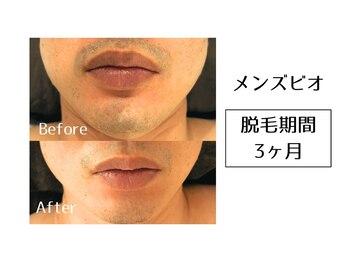 メンズビオ 神戸三宮店/