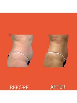 ルアナ(Luana.)/ワンサイズダウン