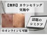 【シミケア】無料カウンセリング/オンライン可能