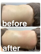 ギンザアール(GINZA R.)/ぽっこりお腹に徹底アプローチ◎