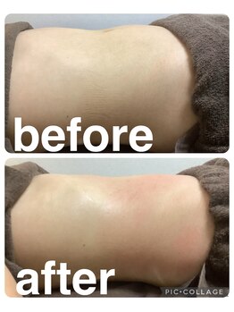 ギンザアール(GINZA R.)/ぽっこりお腹に徹底アプローチ◎