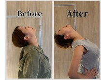 整体ラルース 中目黒(LALUZ)/20代　女性　猫背、巻き肩改善