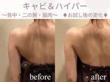 エステティックサロン アールグレー 名古屋駅店/プレ花嫁様/お試し体験後の変化!