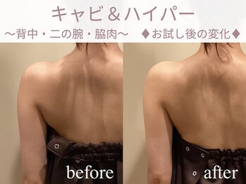 エステティックサロン アールグレー 名古屋駅店/プレ花嫁様/お試し体験後の変化!
