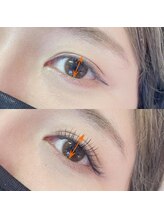 ジル 原店(JilL)/上→before 下→after/まつぱ