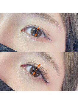 ジル 原店(JilL)/上→before 下→after/まつぱ