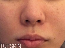 トップスキン 表参道(TOPSKIN)/複合的な肌トラブルお任せ下さい