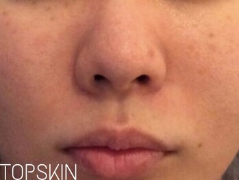 トップスキン 表参道(TOPSKIN)/複合的な肌トラブルお任せ下さい