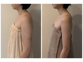 アロラヴィ(AroRavi)/ブライダルエステ