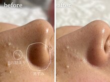 メルシア(merucia)/