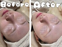 グラシア 倉敷店(Gracia)/お客様の施術事例