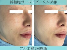 リメイククリニカルビューティー(Remake clinical beauty)/