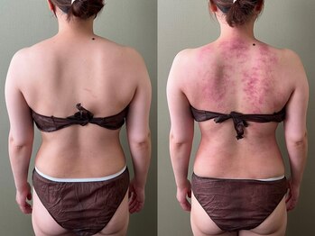 モモリラ(momorila)/セルクラ