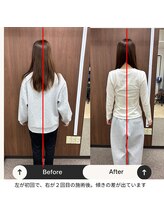 ルピナス整体院/身体の歪みを整えていきます