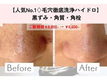 リアン(Lien)の雰囲気（毛穴ケアで垢抜け肌。ホームケアアドバイスで肌悩み繰り返さない）