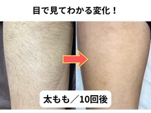 NTエステティック 西条店/