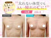 メディカルサロン エム エム エム 大阪梅田グランドサロン(M.M.M)の雰囲気（発育阻害因子を徹底改善！だから痩せ型さんでもバストアップ可能）