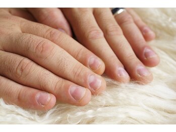 チヒロネイル/爪噛み・深爪さんのためのネイル