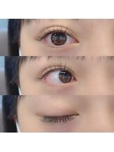 ティエルナ(Tierna)/シングルラッシュ　100本