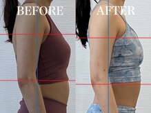 ルア(Lua)/肋骨閉めて胸囲サイズダウン◎