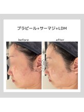 ポムハヌル 大阪梅田中崎町(pom.haneul)/韓国肌管理室