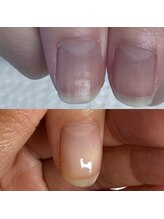 ウェルズユキ(well's yuki)/深爪矯正／自爪育成／ジェル育成