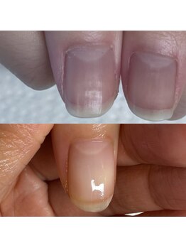 ウェルズユキ(well's yuki)/深爪矯正/自爪育成/ジェル育成