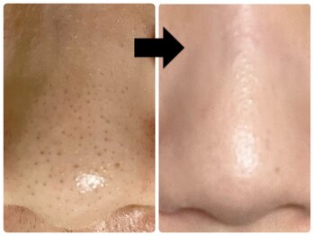 エフェクト 塚口店(effect)/before after