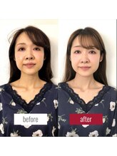 サロンチオリ 烏丸(Salon Chiori)/《40代》若見えフェイスライン