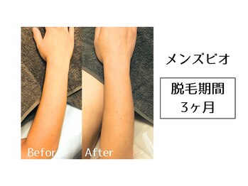 メンズビオ 神戸三宮店/