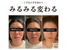 再来女性限定☆小顔頭蓋骨矯正＋美肌美顔器コース¥11500→¥11000　30分