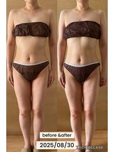 シエスタ リラクゼーションアンドデトックス(Siesta Relaxation&Detox)/冷房冷えで浮腫みが辛かった40代